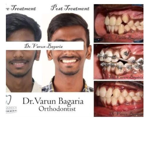 Pineapple Dental Clinic - Specialist Orthodo