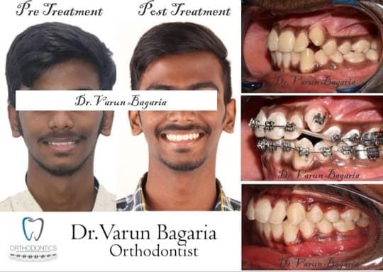 Pineapple Dental Clinic By Dr.Varun Bagaria-